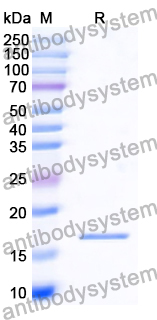 [Antibodysystem] Recombinant Human PGF/PlGF/PLGF Protein, N-His