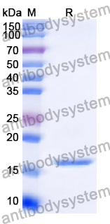 [Antibodysystem] Recombinant Human IL2 Protein, C-His