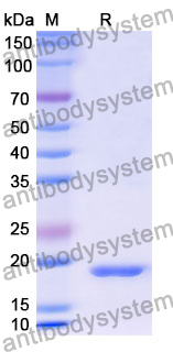 [Antibodysystem] Recombinant Mouse PF4/CXCL4 Protein, N-His-SUMO