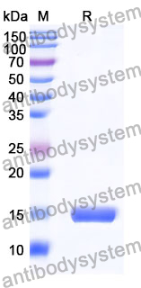 [Antibodysystem] Anti-Human EGFR/ERBB1/HER1 Nanobody (SAA0792)