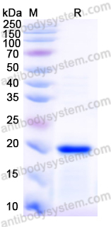 [Antibodysystem] Recombinant Mouse IL36RN/IL-1F5/IL-36Ra Protein, N-His