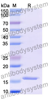 [Antibodysysytem] Recombinant Mouse CXCL5/ENA-78 Protein, N-His-SUMO