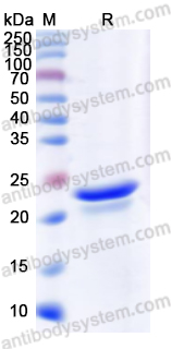 [Antibodysystem] Recombinant Mouse APOE Protein, N-His