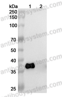 [Antibodysystem] InVivoMAb Anti-Human APOE Antibody (Iv0128)