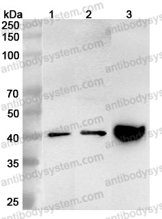 [Antibodysystem] Anti-ASGR1 Polyclonal Antibody