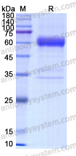 [Antibodysystem] Recombinant Human ASGR1 Protein, N-Fc