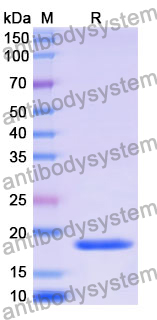 [Antibodysystem] Recombinant Mouse ASGR1 Protein, N-His