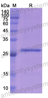 [Antibodysystem] Recombinant Human ASGR1 Protein, N-His