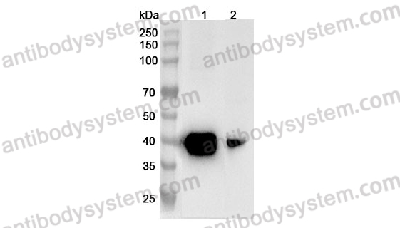 [Antibodysystem] Anti-Mouse ASGR1 Polyclonal Antibody