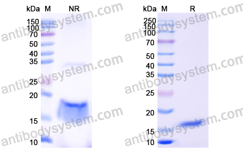 [Antibodysystem] Anti-Human IL6 Nanobody (SAA0798)