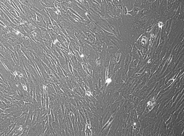 [Vitro Biopharma] Human Ovarian Carcinoma Cancer-Associated Fibroblasts (CAFs): 1,000,000 Cells