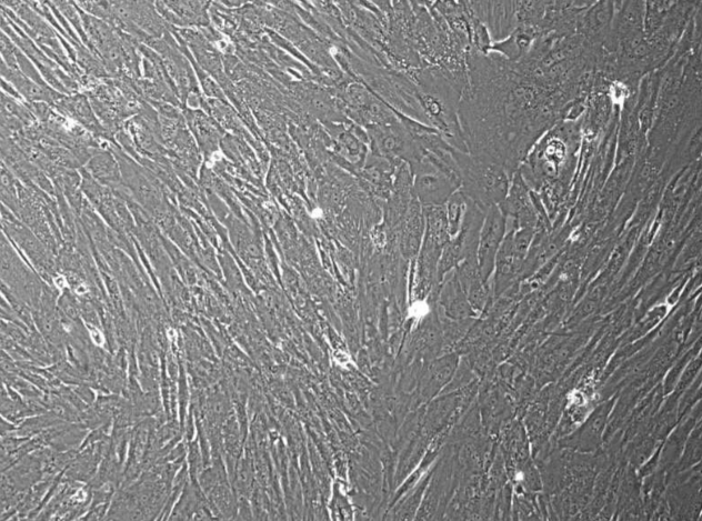[Vitro Biopharma] Human Lung Adenocarcinoma Cancer-Associated Fibroblasts (CAFs): 1,000,000 Cells