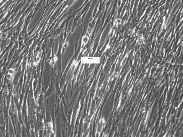 [Vitro Biopharma] Human Pancreatic Adenocarcinoma Cancer-Associated Fibroblasts (CAFs): 1,000,000 Cells