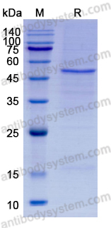 [Antibodysystem] Recombinant SFTSV Mgp1/membrane glycoprotein polyprotein, C-His