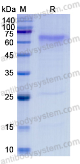 [Antibodysystem] Recombinant SFTS phlebovirus Glycoprotein C/Gc Protein, C-His