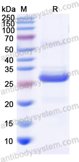 [Antibodysystem] Recombinant Human SLC34A2/NaPi2b Protein, N-His-SUMO