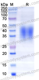 [Antibodysystem] Recombinant EBV/HHV4 GP42/Glycoprotein 42 Protein, C-His