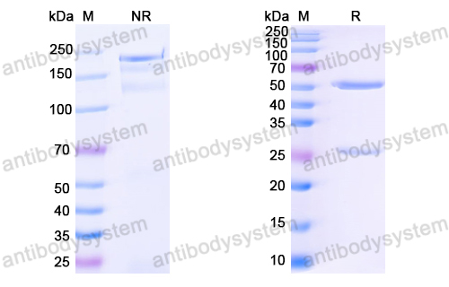 [Antibodysystem] Anti-HCV NS1/gp68/gp70/Envelope glycoprotein E2 Antibody (AP33)