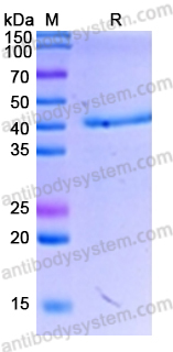 [Antibodysystem] Recombinant Human SLC34A2/NaPi2b Protein, N-GST