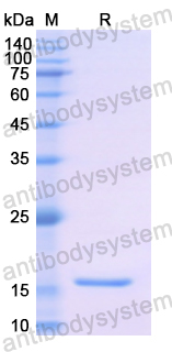 [Antibodysystem] Recombinant Human TTR Protein, N-His