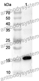 [Antibodysystem] Anti-TTR Polyclonal Antibody