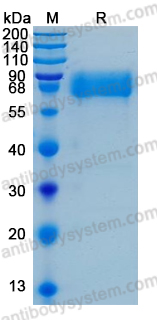 [Antibodysystem] Recombinant Human IFNAR2 Protein, C-hFc-His (Active)