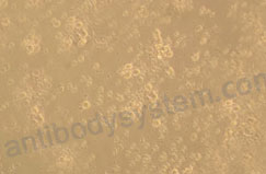 [Antibodysystem] Recombinant Human CD83 Protein, C-His (Active)