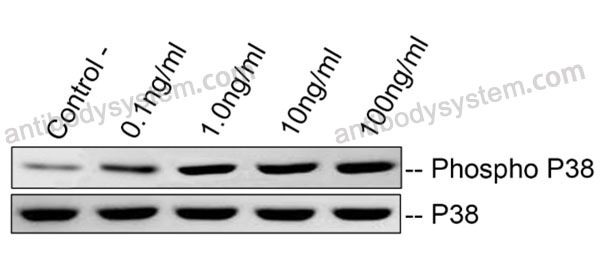 [Antibodysystem] Recombinant Human FNDC5 Protein, C-His (Active)