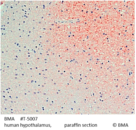 [BMA BIOMEDICALS] Guinea Pig anti Corticotropin Releasing Factor (CRF) (human, mouse, rat)