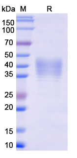 [Proteogenix] Recombinant Monkeypox virus/MPXV E8L Protein