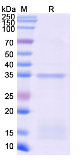 [Proteogenix] Recombinant Monkeypox virus/MPXV D13L Protein, N-His