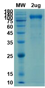 [Proteogenix] ACE2 protein – Soluble ectodomain of human ACE-2 (aa 1-740)