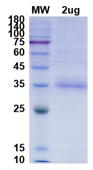 [Proteogenix] SARS-CoV-2 RBD of Spike protein, K417N, E484K, N501Y – B.1.351 lineage – SA Beta Variant