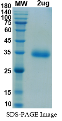[Proteogenix] SARS-CoV-2 RBD of Spike protein, K417T, E484K, N501Y – lineage B.1.1.28.1 – BR Gamma Variant