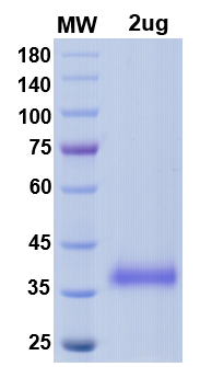 [Proteogenix] SARS-CoV-2 RBD of Spike protein, L452R, T478K – lineage B.1.617.2 – Indian Delta Variant