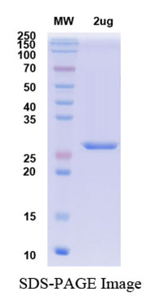 [Proteogenix] SARS-CoV-2 RBD of Spike protein– lineage B.1.1.529 – Omicron Variant