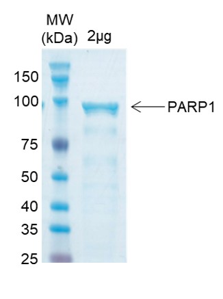 [Proteogenix] Human PARP1 Recombinant Protein