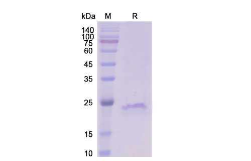 [Proteogenix] CD20 Protein – Human CD20 Recombinant Protein
