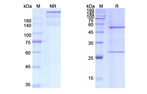 [Proteogenix] Dezamizumab Biosimilar – Anti-APCS mAb – Research Grade