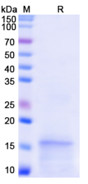 [Proteogenix] Monkeypox virus/MPXV D6L Recombinant Protein, N-His