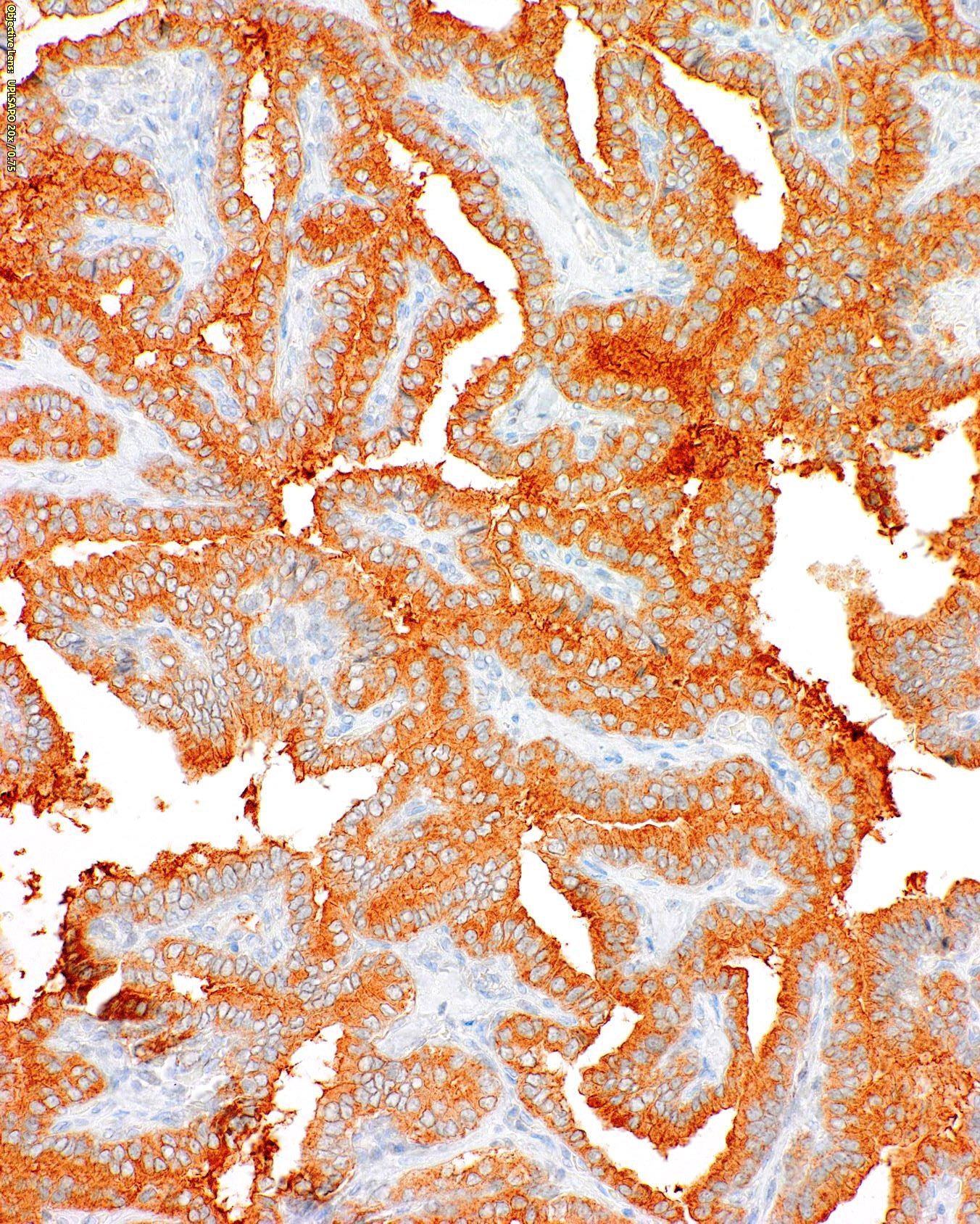 [GenomeMe] BRAF V600E