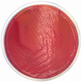 [Condalab] Yersinia Selective Agar Base (CIN) ISO