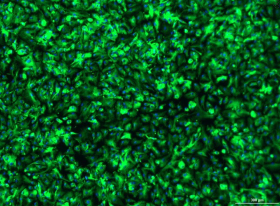 [Vitro Biopharma] Human Glioblastoma Cancer-Associated Fibroblasts (CAFs): 1,000,000 Cells