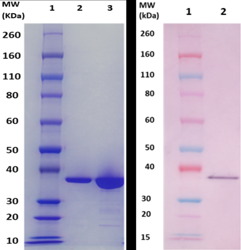 [IBT Bioservices] FhuD2 protein (S. aureus)