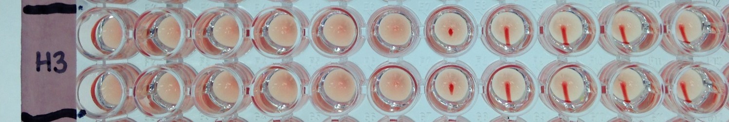 [IBT Bioservices] Influenza Hemagglutinin Glycoprotein (H3N2) – A/Wisconsin/67/2005