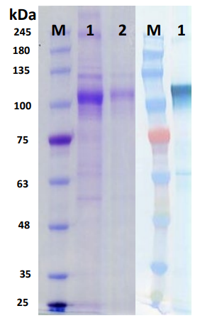 [IBT Bioservices] Sin Nombre Virus Glycoprotein (GPC)