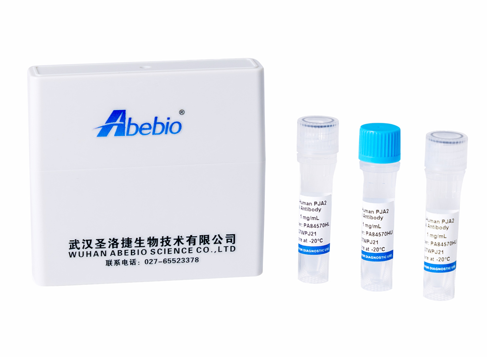 [Abebio] Rabbit Anti-Mouse Robo4 Polyclonal Antibody