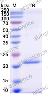 [Abinscience] Recombinant Human FGF21 Protein, C-His (HV802011)