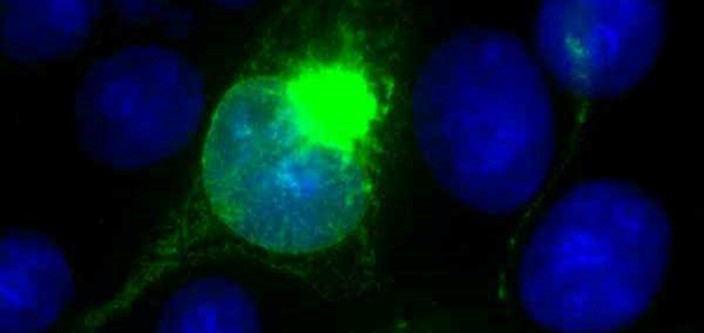 [IBT Bioservices] Anti-Japanese Encephalitis Virus Antibody, JE1