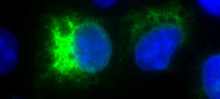 [IBT Bioservices] Anti-Japanese Encephalitis Virus NS1 Antibody, JN1
